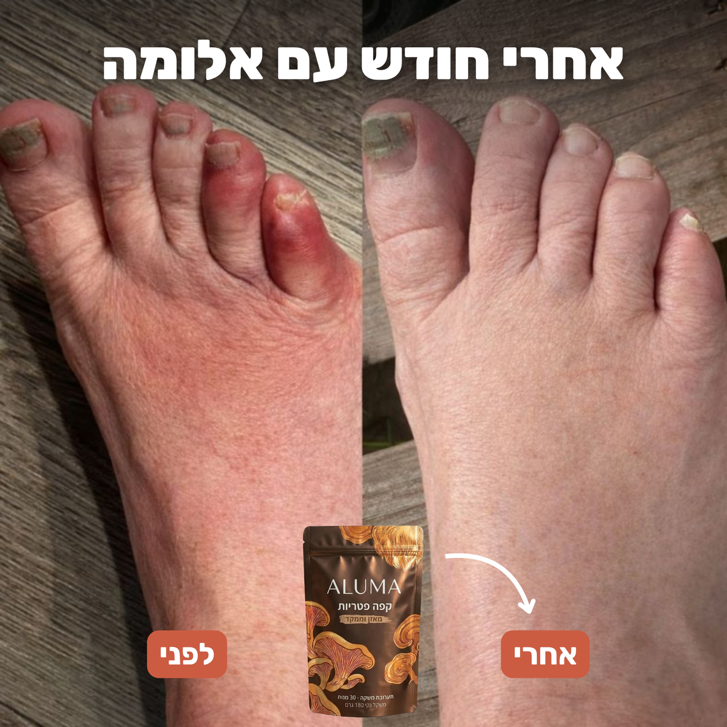 ALUMA - הפסיקו תחושת נימול , עקצוץ ושריפה מהכוס הראשונה