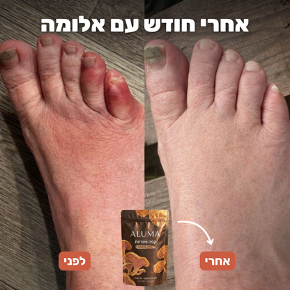 ALUMA - הפסיקו תחושת נימול , עקצוץ ושריפה מהכוס הראשונה